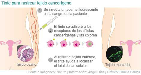 ayuda20fluorecente20contra20cancer