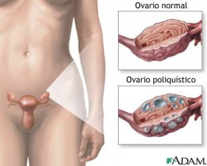 OVARIO1