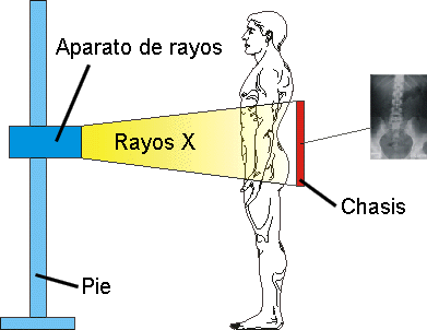 los_rayos_X