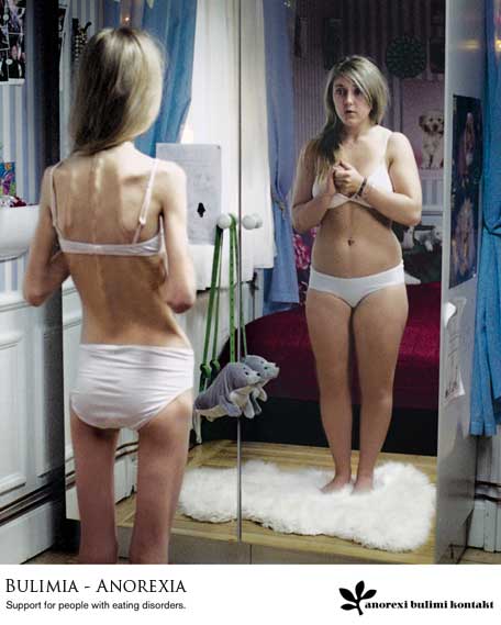 anorexia-y-bulimia15688998564345