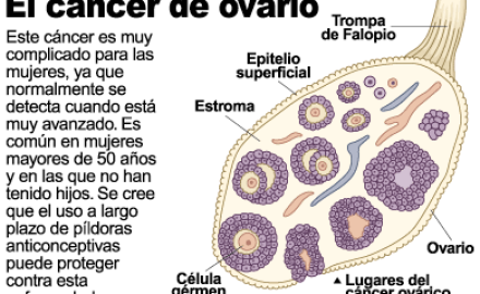 cancer-de-ovario