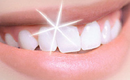 dientes_mas-blancos