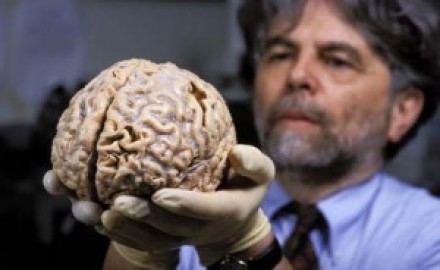 cerebro-humano-300x200