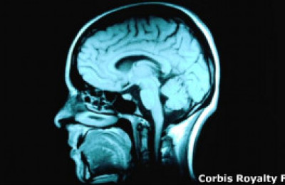 110919100406_epilepsy_schizophrenia_linked_304x171_corbisroyaltyfree