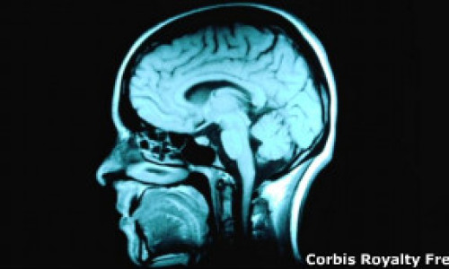 110919100406_epilepsy_schizophrenia_linked_304x171_corbisroyaltyfree