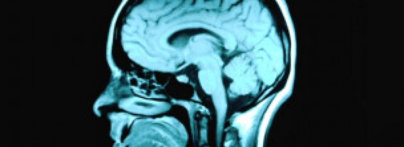 110919100406_epilepsy_schizophrenia_linked_304x171_corbisroyaltyfree