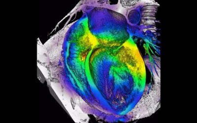 Nanocables_de_oro_corazon