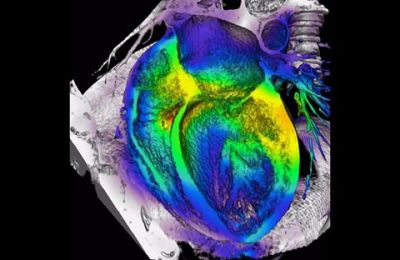Nanocables_de_oro_corazon