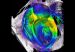 Nanocables_de_oro_corazon