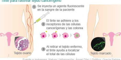 ayuda20fluorecente20contra20cancer