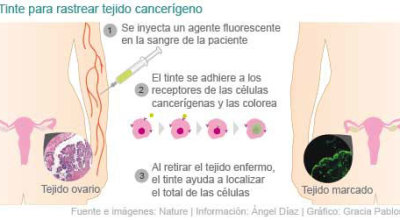 ayuda20fluorecente20contra20cancer