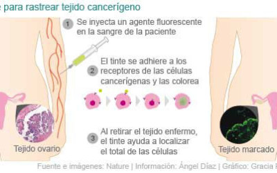 ayuda20fluorecente20contra20cancer