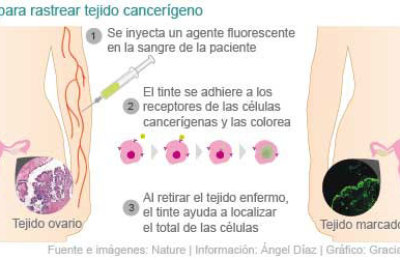 ayuda20fluorecente20contra20cancer