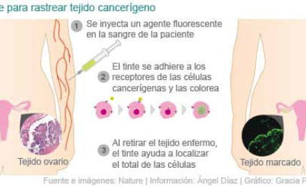 ayuda20fluorecente20contra20cancer