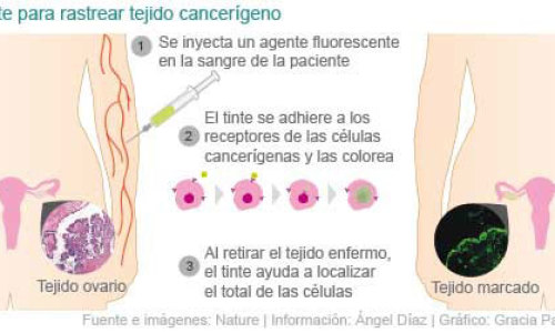 ayuda20fluorecente20contra20cancer