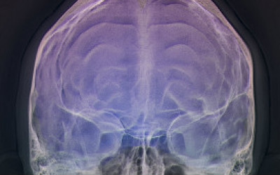 cerebro-brain