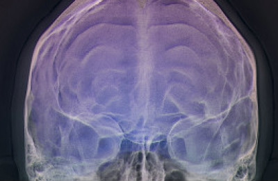 cerebro-brain