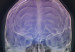 cerebro-brain