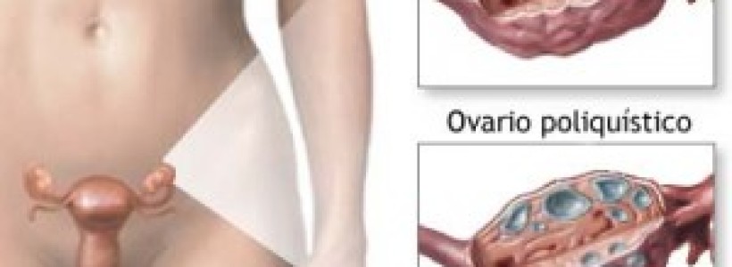 OVARIO1