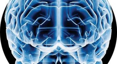 cerebro34656