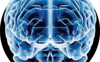 cerebro34656