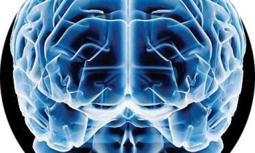 cerebro34656