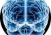 cerebro34656