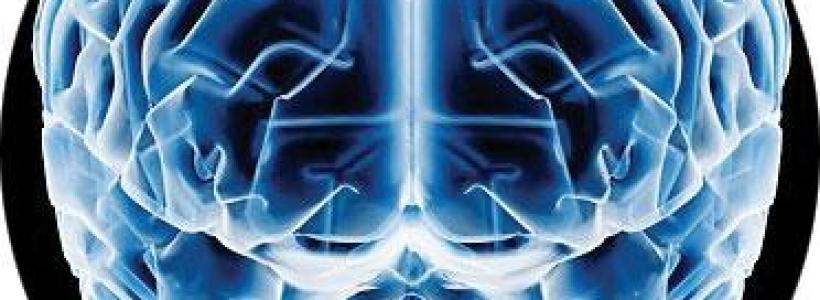 cerebro34656