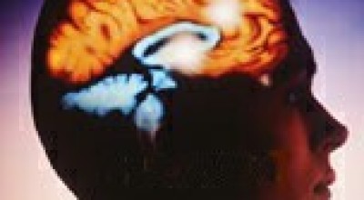 cerebro46567