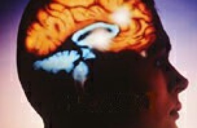 cerebro46567