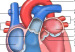 corazon5547