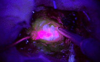 fosforescencia.7567568jpg