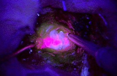 fosforescencia.7567568jpg