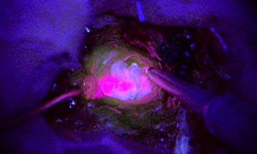 fosforescencia.7567568jpg