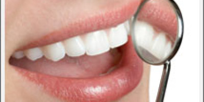 limpieza_dental34643567453