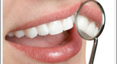 limpieza_dental34643567453