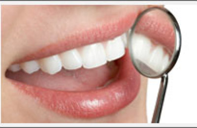 limpieza_dental34643567453