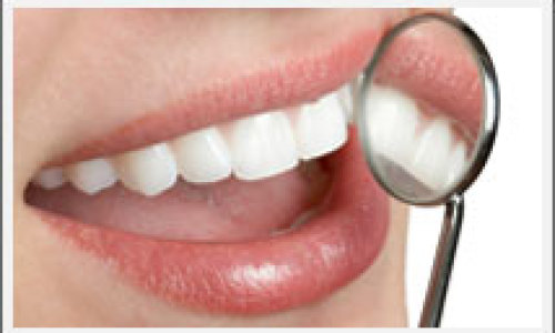 limpieza_dental34643567453