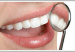 limpieza_dental34643567453