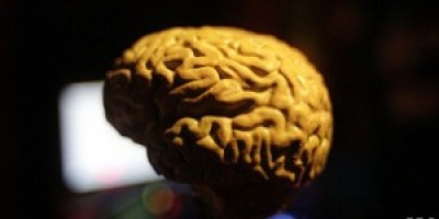 Las-vitaminas-y-omega-3-evitan-el-encogimiento-del-cerebro-asociado-a-Alzheimer-300x168