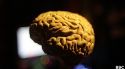 Las-vitaminas-y-omega-3-evitan-el-encogimiento-del-cerebro-asociado-a-Alzheimer-300x168