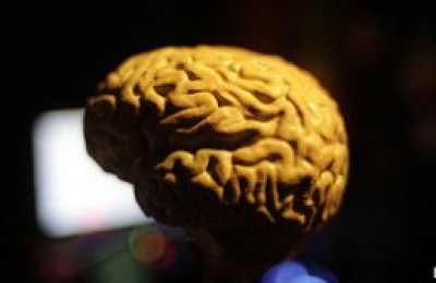 Las-vitaminas-y-omega-3-evitan-el-encogimiento-del-cerebro-asociado-a-Alzheimer-300x168