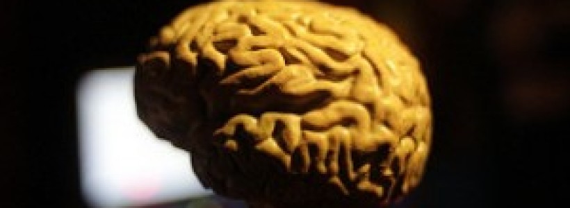 Las-vitaminas-y-omega-3-evitan-el-encogimiento-del-cerebro-asociado-a-Alzheimer-300x168