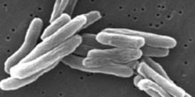 Mycobacterium_tuberculosis