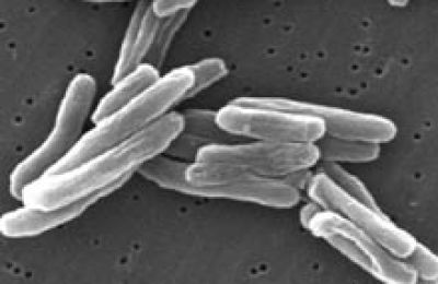 Mycobacterium_tuberculosis