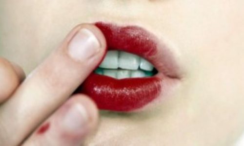 No_labios_resecos