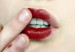No_labios_resecos