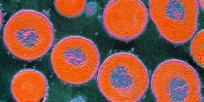 La-bacteria-de-neumococo-logra-evadir-la-vacuna-intercambiando-la-cpsula-que-la-recubre.-300x168