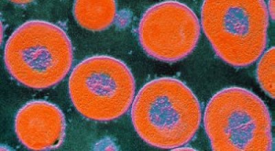 La-bacteria-de-neumococo-logra-evadir-la-vacuna-intercambiando-la-cpsula-que-la-recubre.-300x168