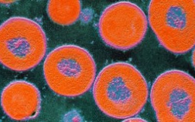 La-bacteria-de-neumococo-logra-evadir-la-vacuna-intercambiando-la-cpsula-que-la-recubre.-300x168